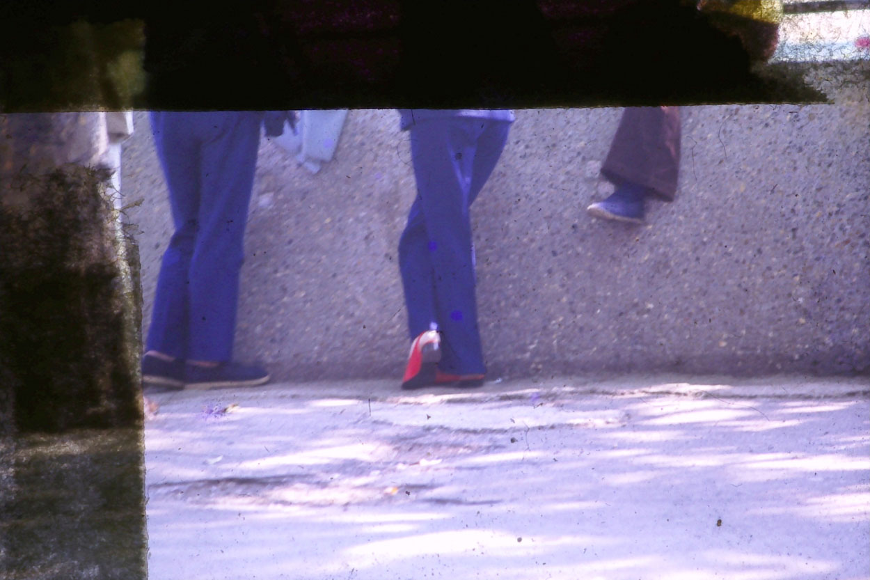 More photos of legs.